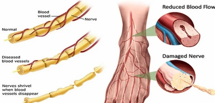 pain in feet